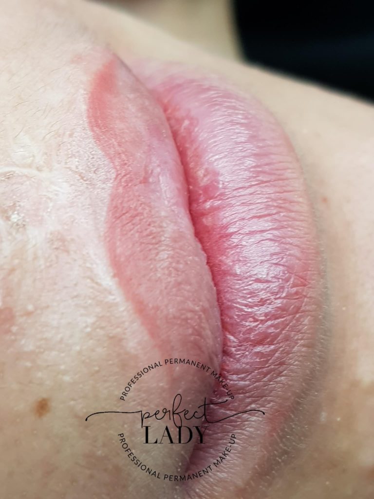 permanente make-up lippen na schisis resultaat