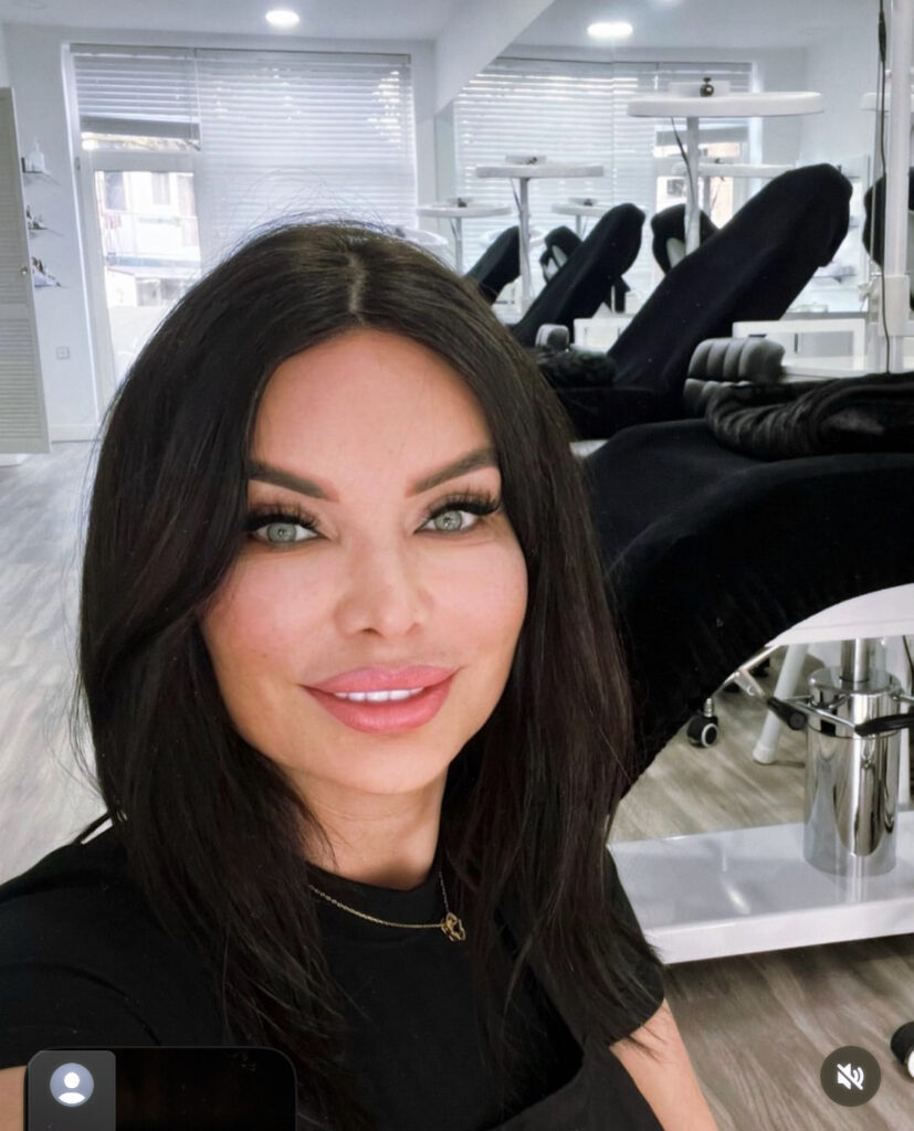 PMU verwijderen in Schiedam met ND:YAG laser bij Perfect Lady